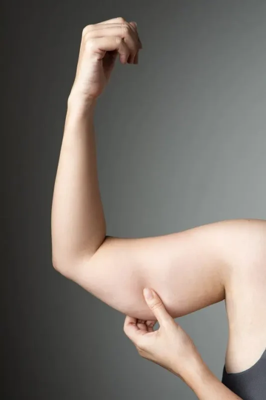 arm-lift