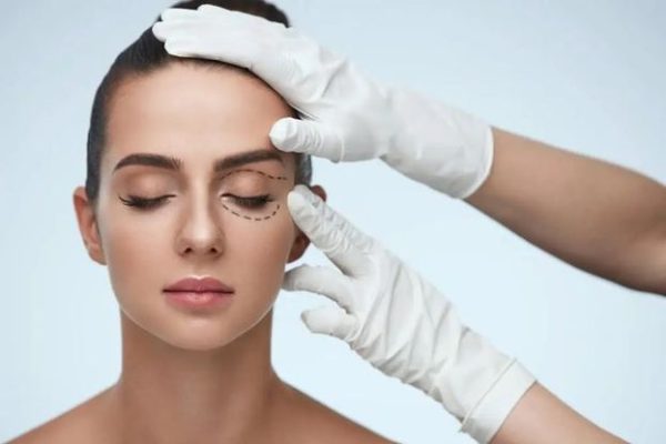 blepharoplasty-surgery