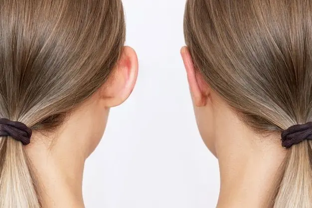 ear-correction-surgery