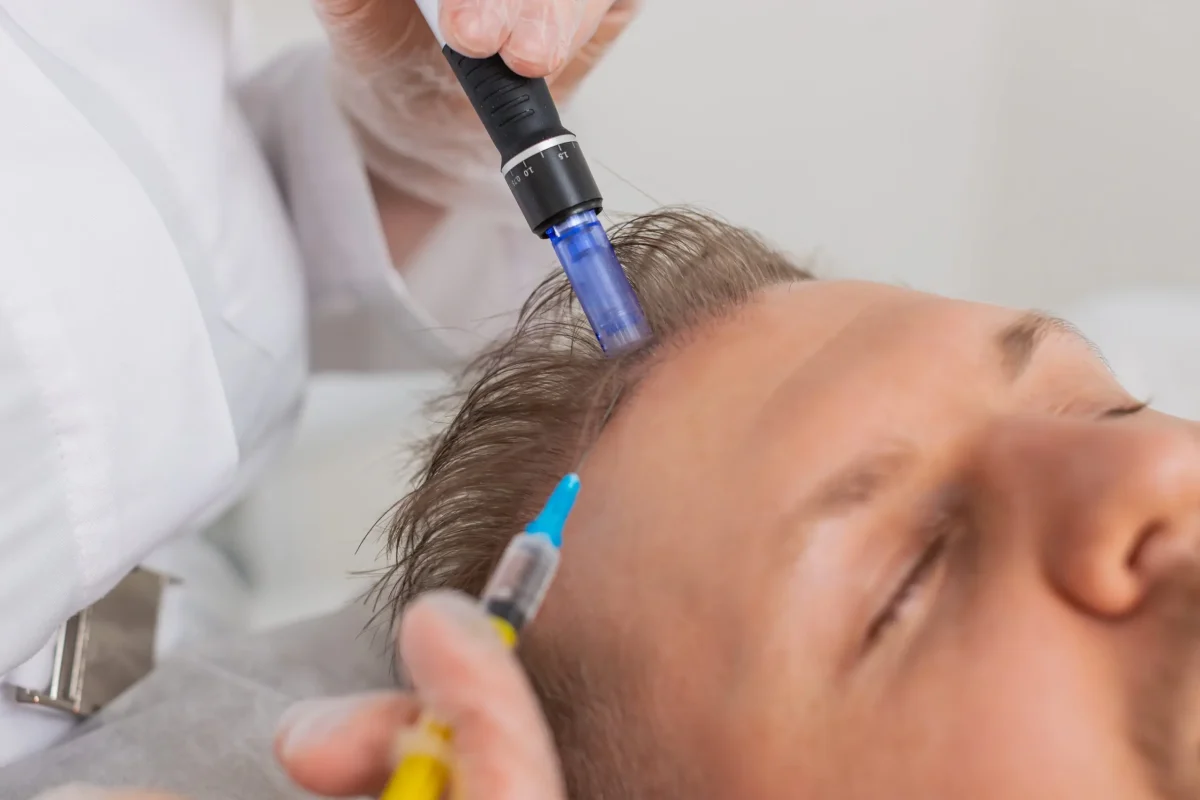 exosomes-hair-therapy-for-men