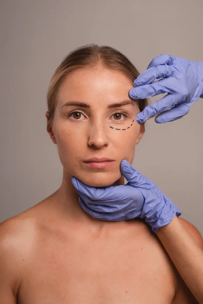 Eyelid Surgery