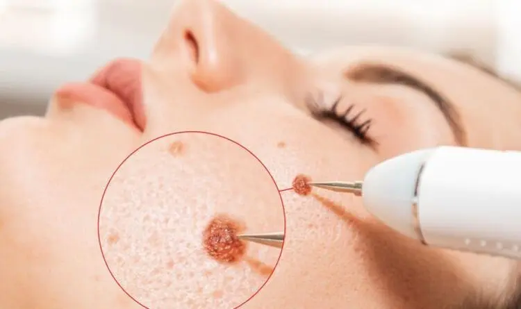facial-skin-cancer-treatment