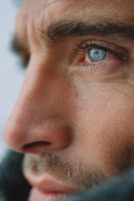 male-blepharoplasty