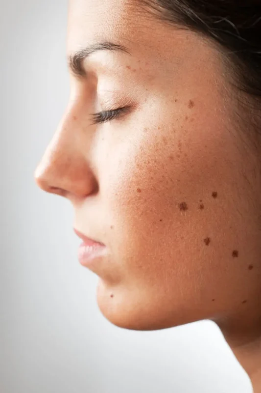 skin-cancers-img
