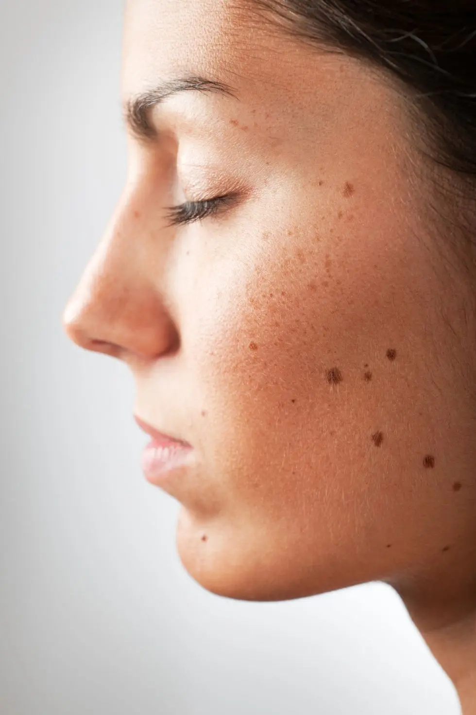 skin-cancers-img