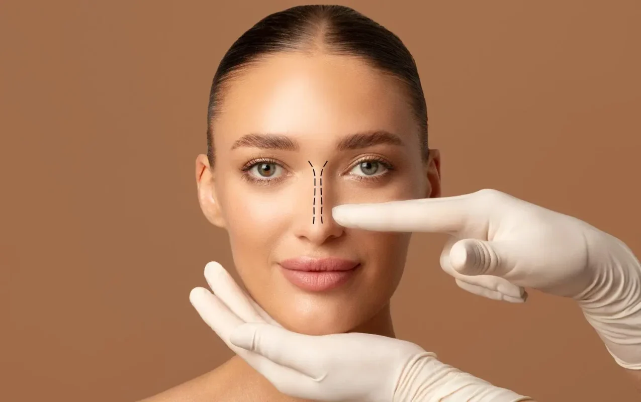 rhinoplasty-dubai