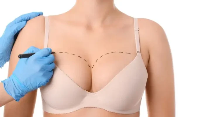 breast-fat-grafting