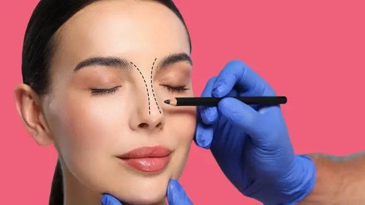 revision-rhinoplasty